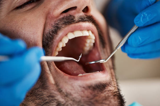 Best Emergency Treatment for Jaw Pain or Injury in Harmony Grove, CA
